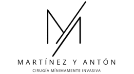 Antoncmi